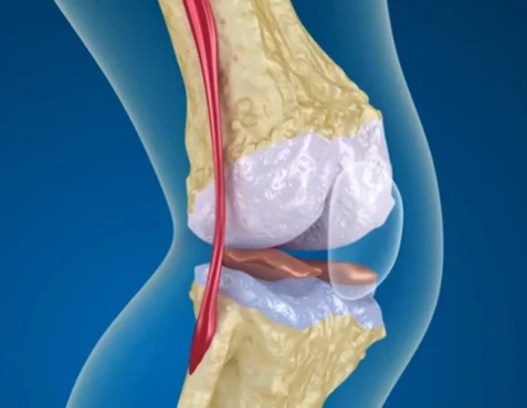 Cartilage support icon