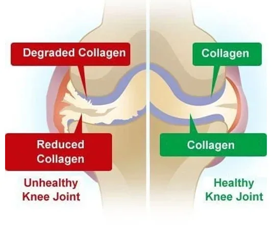 Cartilage and collagen illustration for a guide to glucosamine, MSM and devil's claw