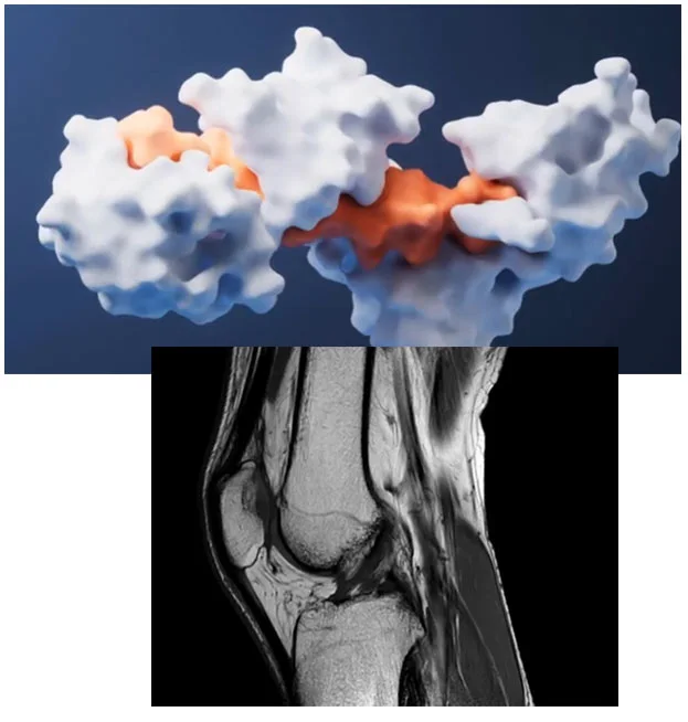 Illustration of an oxidized, worn joint that antioxidant nutrients are designed to support